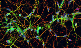 Human Aging Basal Forebrain Cholinergic Neuron
