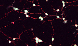 Human Aging GABAergic Inhibitory Neuron